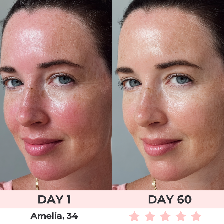 Filoriya™ - LED Face Mask